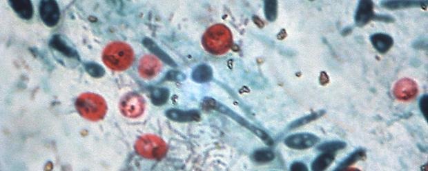 Mikroskopbild på cryptosporidium